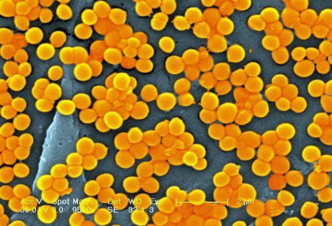 batteri di stafilococco mrsa resistenti alla meticillina